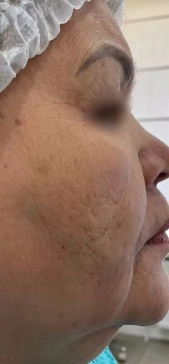 До